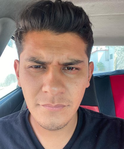 JOSE ALBERTO