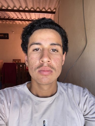ERICK